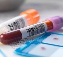 Diagnostic en laboratoire de la prostatite