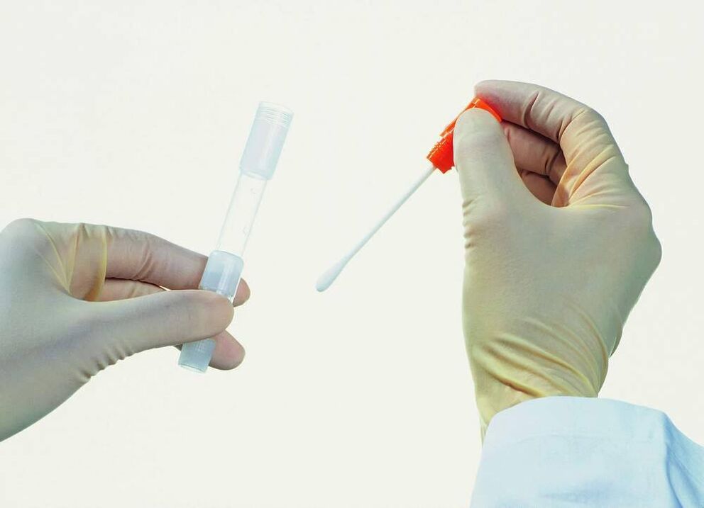 Collection d'analyse pour la détection de la prostatite chronique