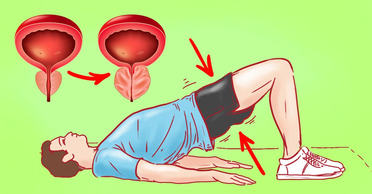 Exercices thérapeutiques dans la prostatite chronique