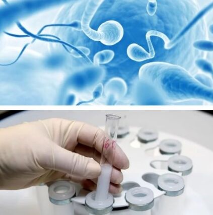 Spermogramme