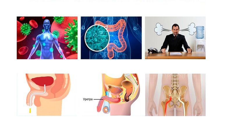 Causes de la prostatite