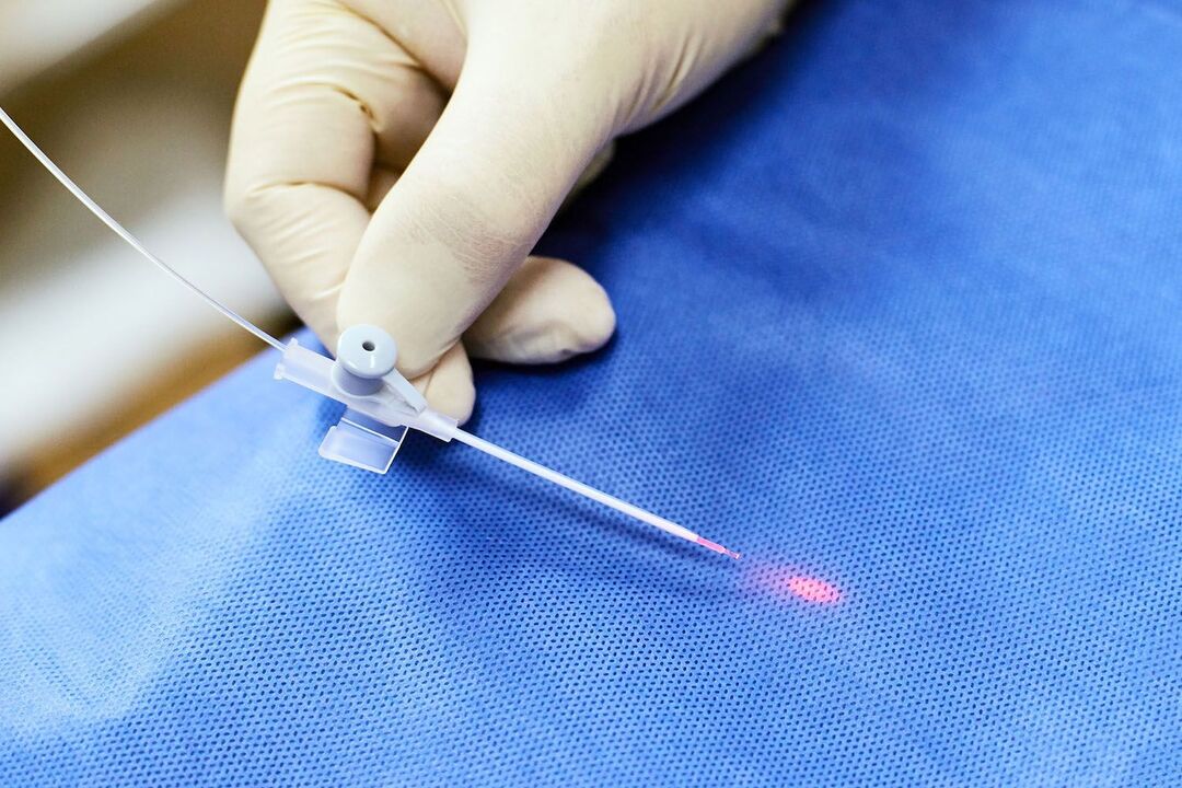 Dispositif transrectal pour le traitement de la prostate